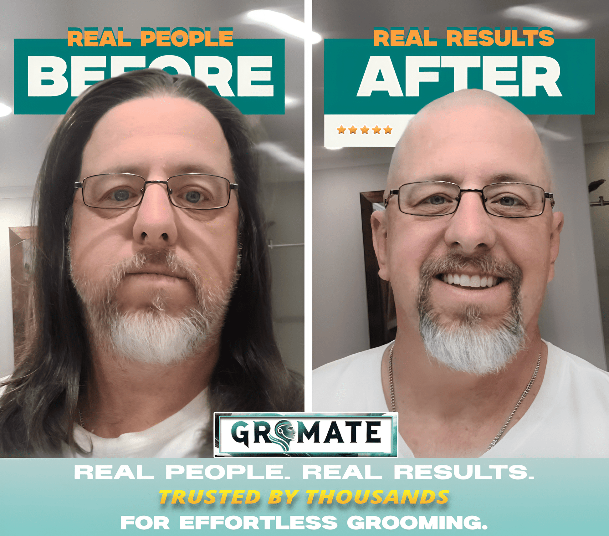 Before and after results of a man using the ShaveMate™ Elite grooming kit, showcasing a transformation to a clean, bald head and well-groomed beard.