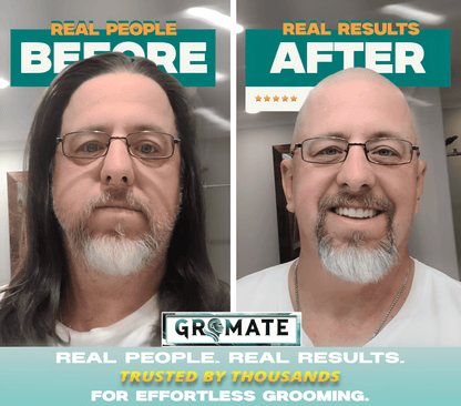 Before and after results of a man using the ShaveMate™ Elite grooming kit, showcasing a transformation to a clean, bald head and well-groomed beard.