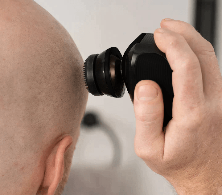 Man using the ShaveMate™ Elite scalp exfoliator attachment to cleanse and smooth the scalp for a refreshed grooming experience.
